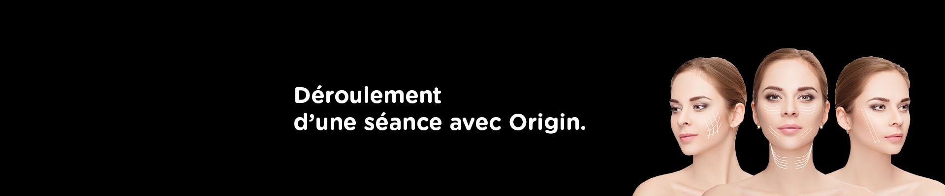 Déroulement d'une séance avec le laser Origin